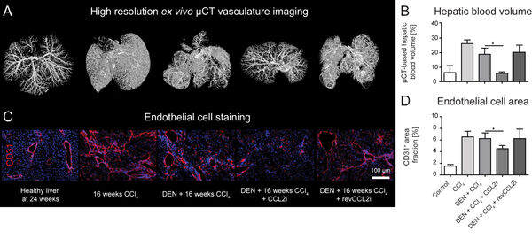 Figure 10: Studies employing nucleic acid-based (DNA aptamer) to inhibit monocyte infiltration into the liver. (A) High-resolution ex vivo μ-CT imaging (after perfusion with Microfil, a lead-containing radiopaque contrast agent) enables a detailed 3D examination of the vascular microarchitecture. (B) Quantification of the hepatic blood volume. (C) Staining of the liver sinusoidal endothelial cells in the liver and (D) quantification of the area covered by endothelial cells. Published own study.9 