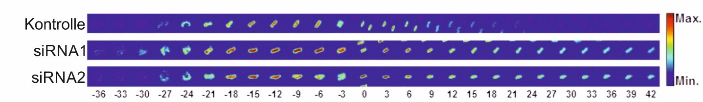 Das Chromatin, das durch ein fluoreszierendes Histonfusionsprotein sichtbar gemacht wird, wird mithilfe von Live-Cell-Imaging während der Mitose verfolgt. Die Intensität der Färbung, die die Chromatindichte anzeigt, ist in einer Falschfarbendarstellung dargestellt. Bis zur Metaphase verdichtet sich das Chromatin, was an der roten Färbung erkennbar ist, und nach der Segregation entpackt es sich wieder. Die Herunterregulierung von Zielgenen (siRNA1 und siRNA2) verlangsamt deutlich den Prozess der Chromatinentpackung.