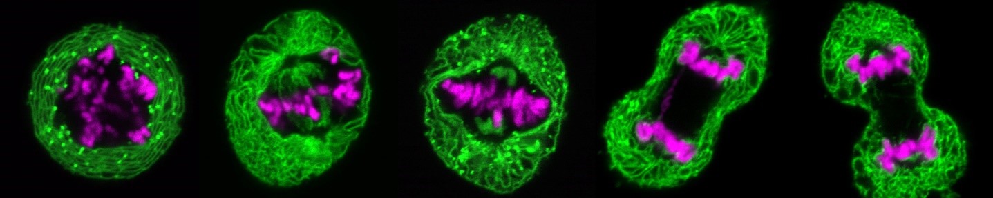 Live cell imaging of a HeLa cell during mitosis. The endoplasmic reticulum is marked in green, while the chromatin is colored purple.